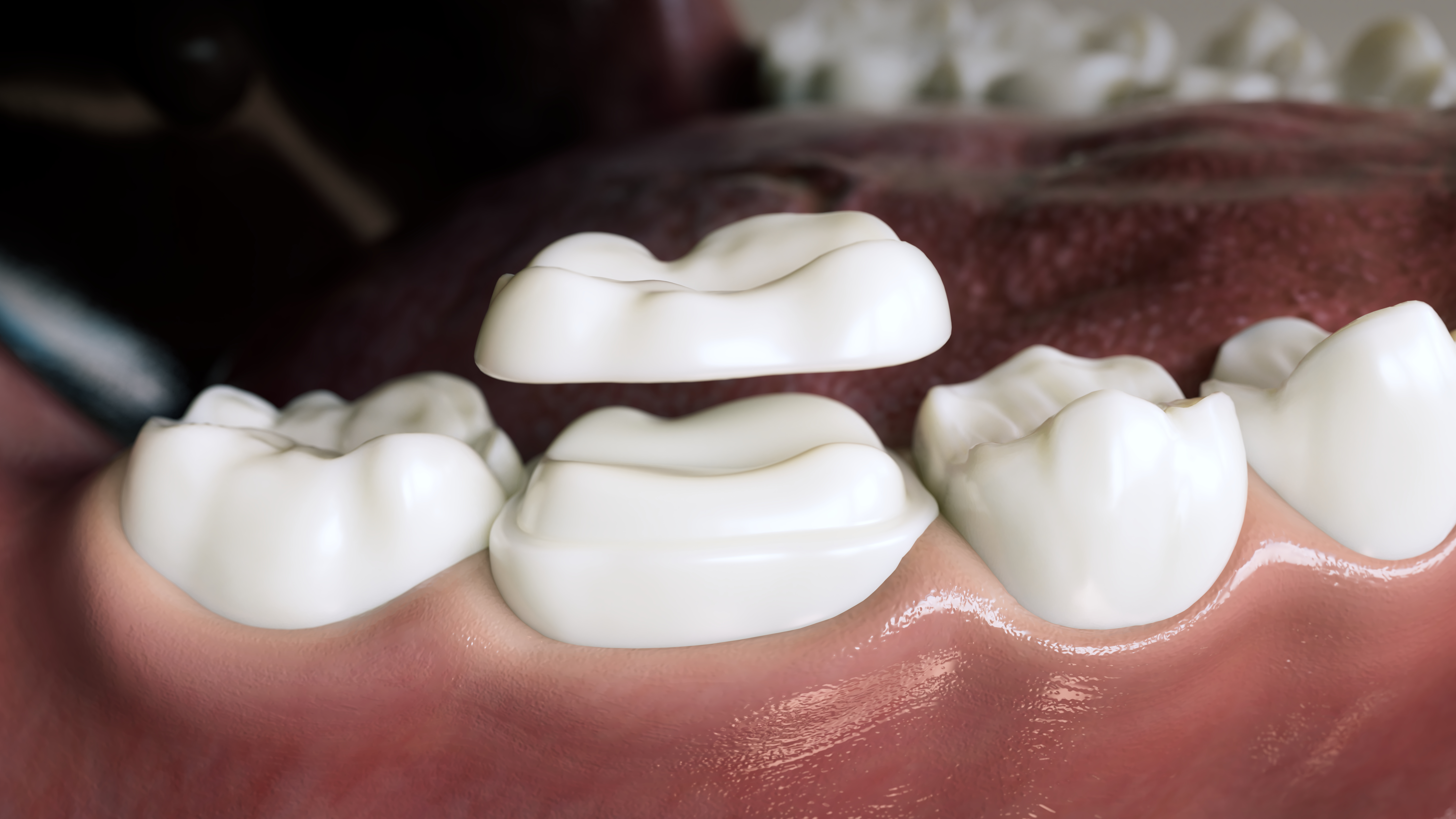 Emery L. Edwards DDS Emery L. Edwards DDS